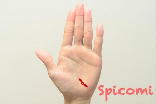 手相占いで旅行線が鎖状