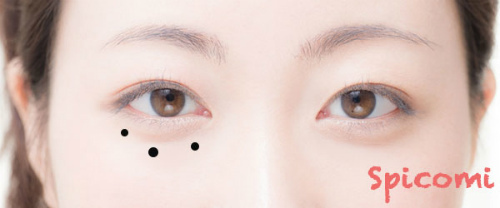 ［ほくろ占い］目の下に3つ以上複数のほくろがある