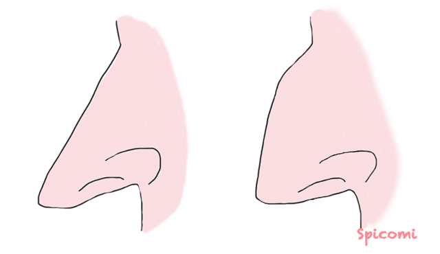 魔女鼻と鷲鼻の違い