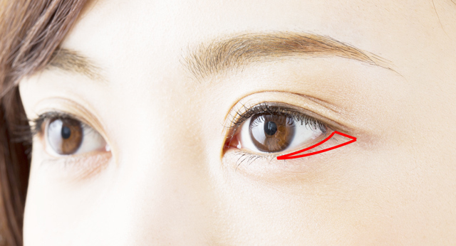 目尻の溝・くぼみの名前は？