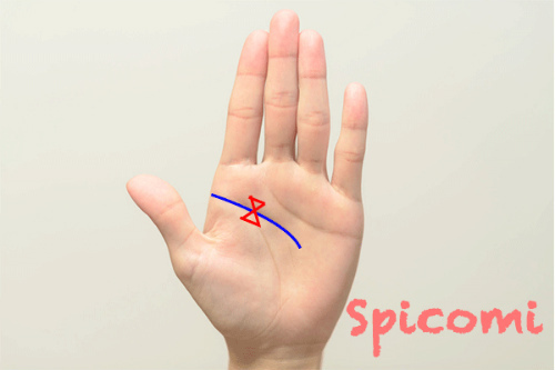 蝶々紋（リボンマーク）が頭脳線・知能線上にある