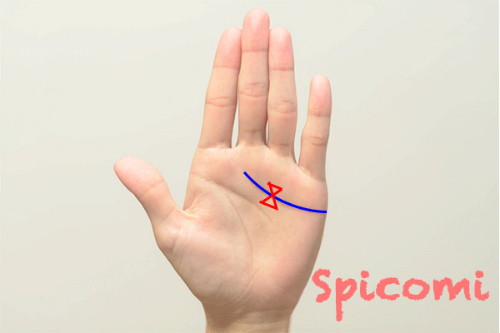 蝶々紋（リボンマーク）が感情線上にある