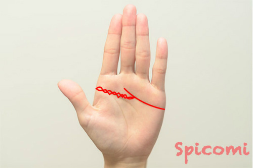 変形ますかけ線が鎖状になっている場合