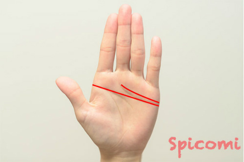 二重感情線を持つ変形ますかけ線の場合