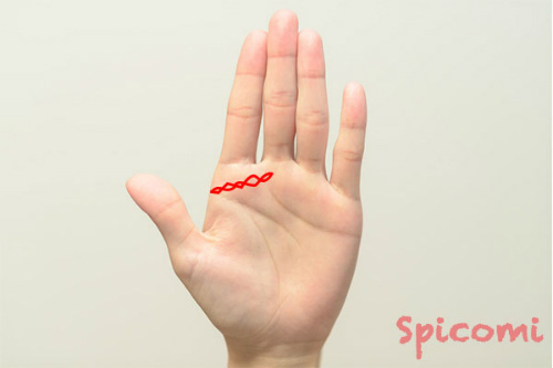 千金紋（成り上がり線）が鎖状になっている場合