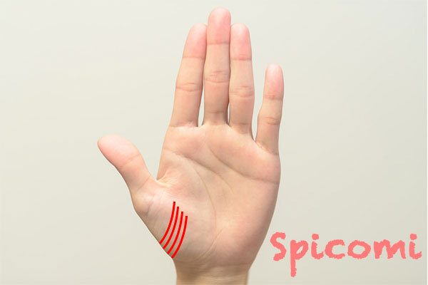 陰徳線がたくさん・多い