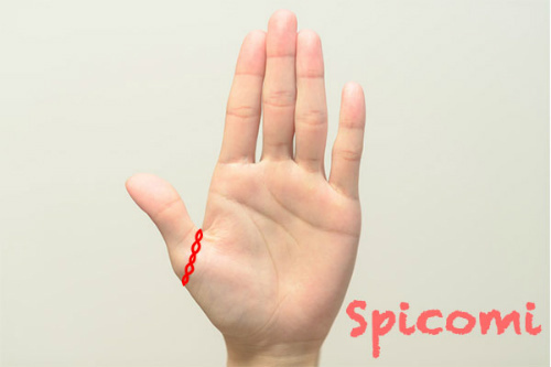 手相占いで親指の付け根が鎖状