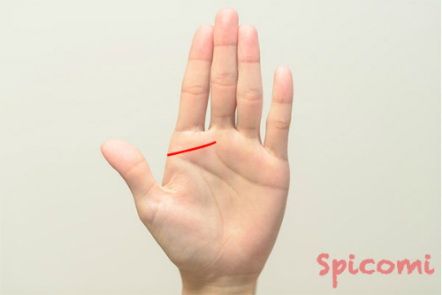 千金紋（成り上がり線）が短い場合